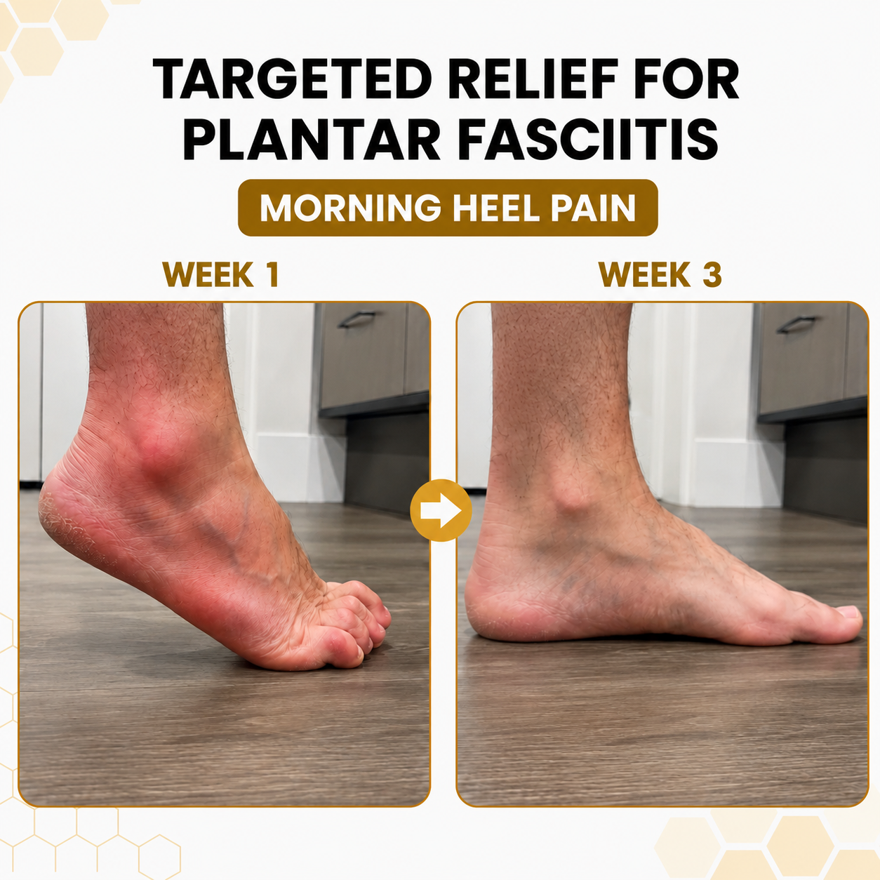Sfrcord® Foot Sleeves — Fast Foot Pain Relief & All-Day Support 🌿