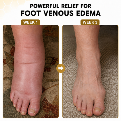 Sfrcord® Foot Sleeves — Fast Foot Pain Relief & All-Day Support 🌿